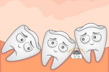 Poussée dents